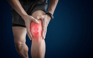 CBD oil for arthritis