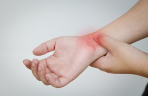 CBD oil for neuropathy