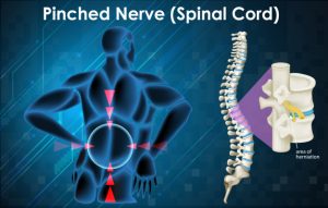 CBD oil to protect nerves